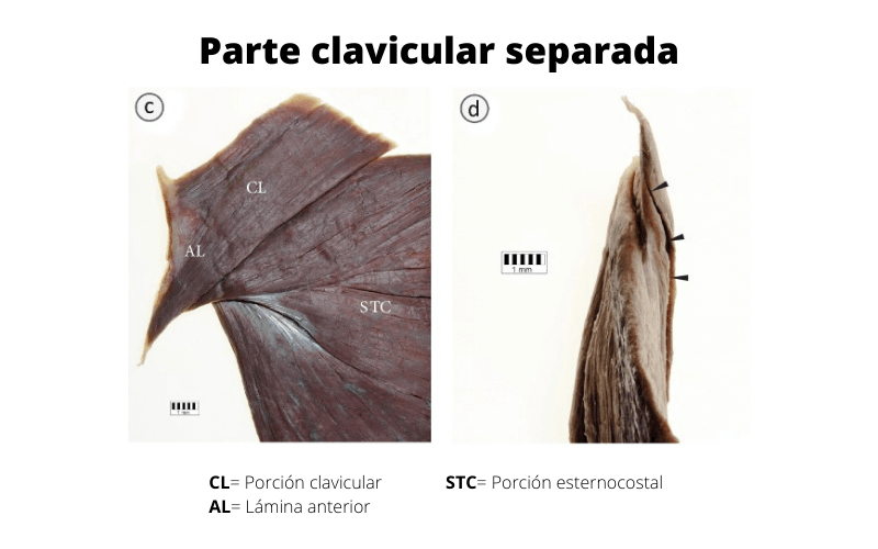 Parte Clavicular B.png